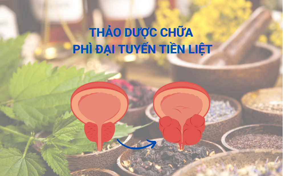 Những loại thảo dược giúp giảm phì đại tuyến tiền liệt an toàn hiệu quả